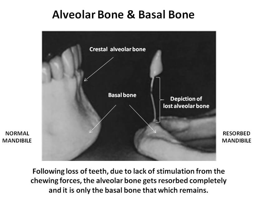 ami-dental-house-basal-implantology