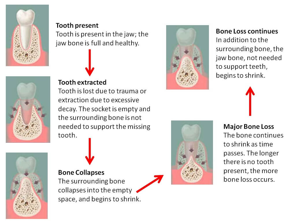 ami-dental-house-basal-implantology