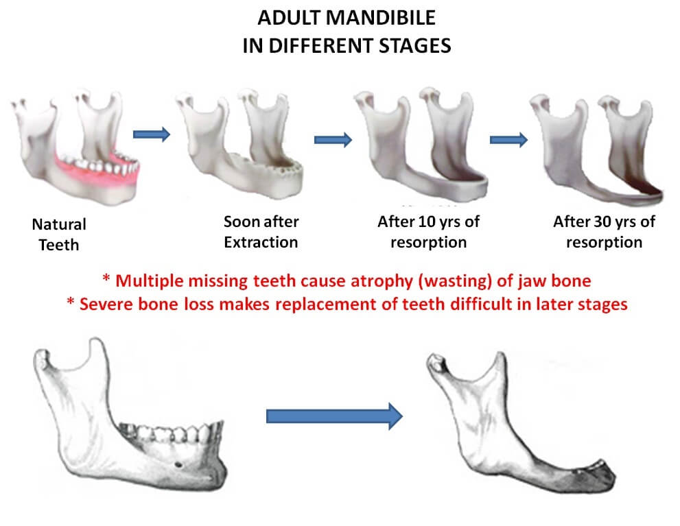 ami-dental-house-basal-implantology