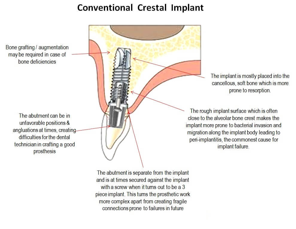 ami-dental-house-basal-implantology