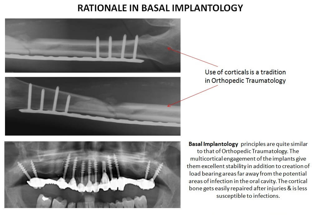 ami-dental-house-basal-implantology