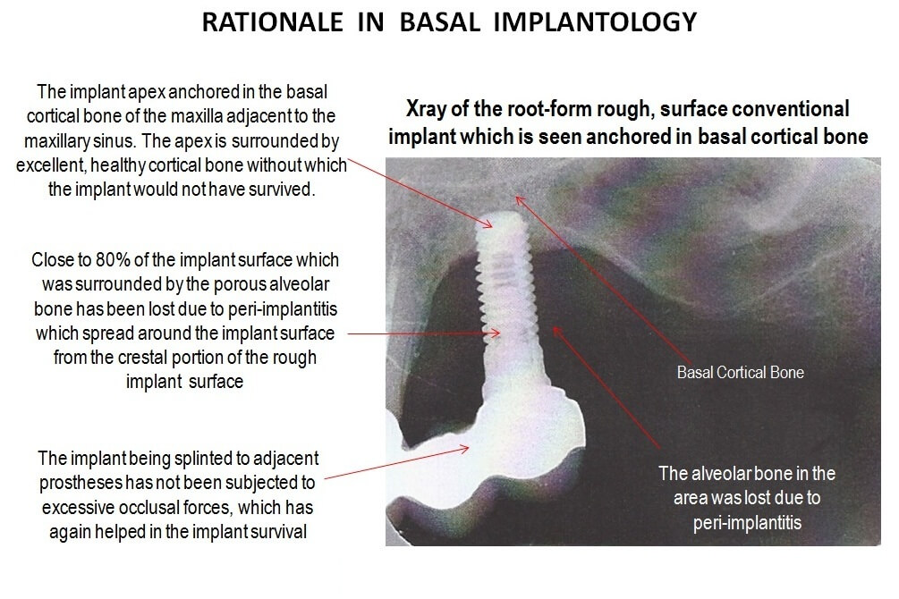 ami-dental-house-basal-implantology