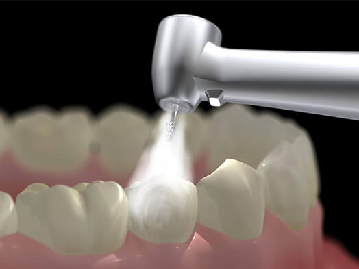 ami-dental-house-dental-restoration